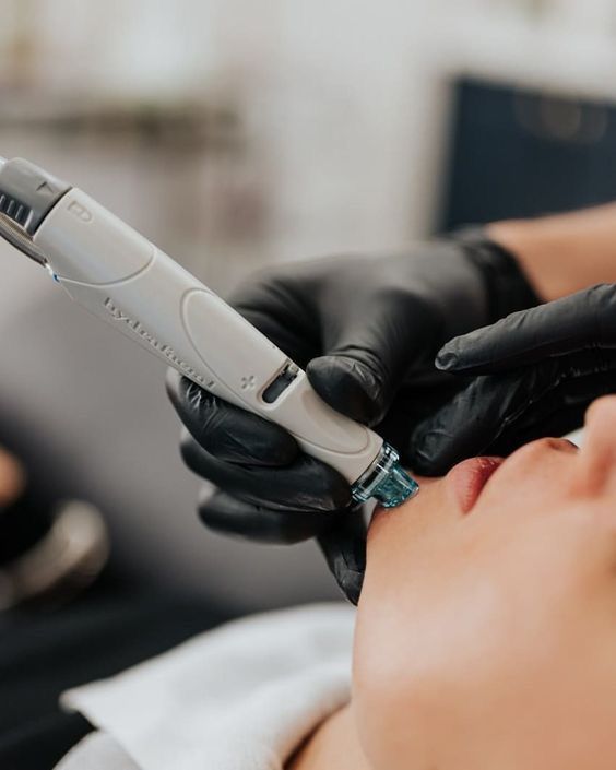 Hydrafacial behandeling voor huidverbetering